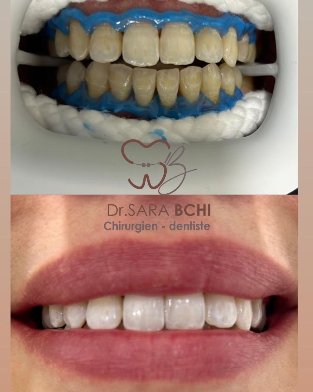 design sans titre (1)